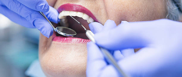 Best Emergency Dentist Open Today  in Choudrant, LA